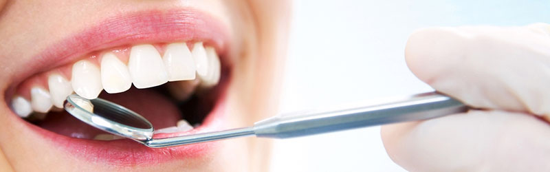 Preventivi denti fissi Palermo